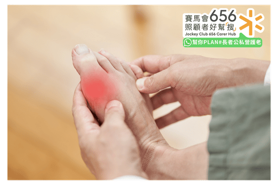 【糖尿病足護理指南】如何辨識糖尿病足初期症狀?日常護理改善及治療方法 2 糖尿病足由神經與血管病變形成過程