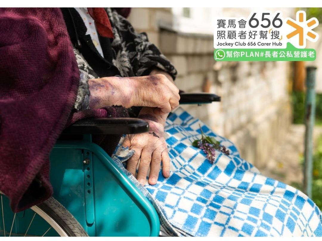 傷殘津貼申請全攻略:程序、資格、金額及文件清單 4 嚴重殘疾申請人